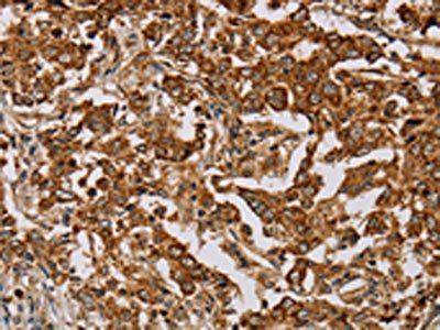MB Antibody