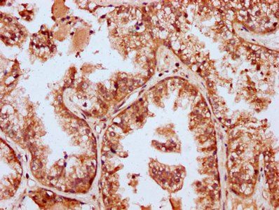 MBNL3 Antibody