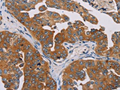 MBNL3 Antibody