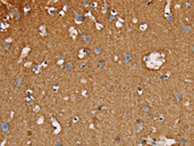 MBNL3 Antibody