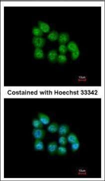 MBNL3 antibody