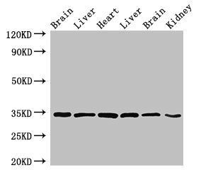 MBP antibody