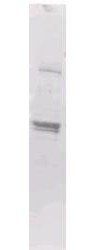 MBP Epitope Tag antibody (Biotin)