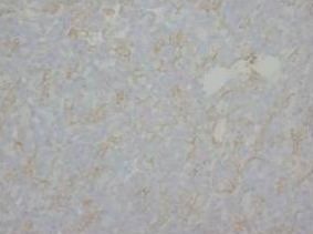 Anti-Myelin Basic Protein/MBP Antibody