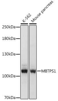 MBTPS1 antibody