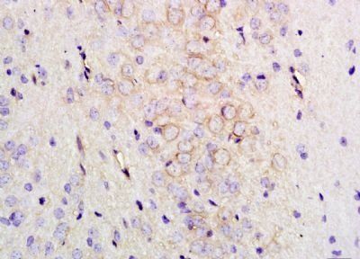 MC3 Receptor Rabbit Polyclonal Antibody