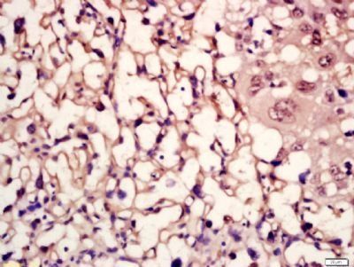 MC5 Receptor Rabbit Polyclonal Antibody