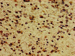 MC5R Antibody