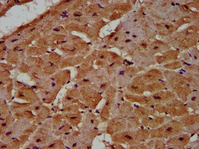 MCC Antibody