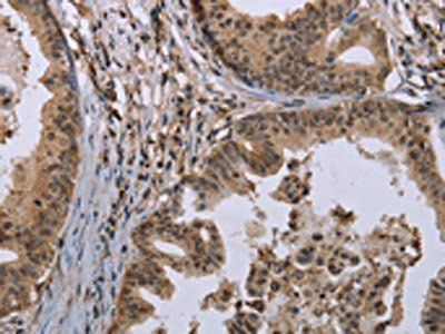 MCC Antibody