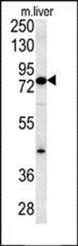 MCCC1 antibody