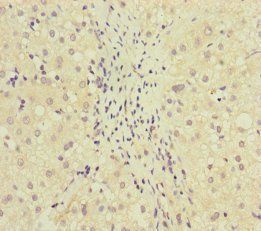 MCCC1 Antibody
