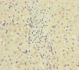 MCCC1 antibody