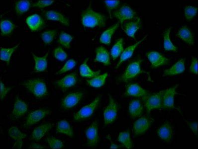 MCCC1 antibody