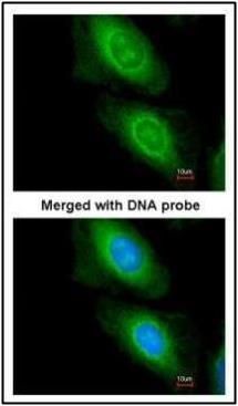 MCD antibody