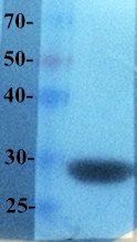 mCherry antibody