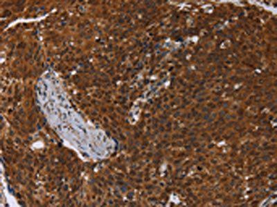 MCHR1 Antibody