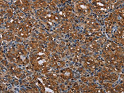 MCHR1 antibody