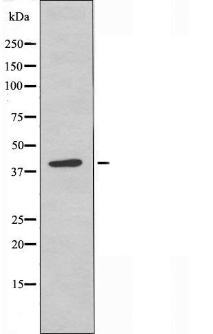 MCHR2 antibody