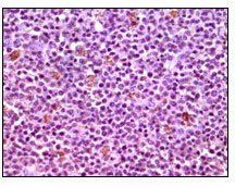 MCL-1 Antibody