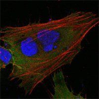 MCL-1 Antibody