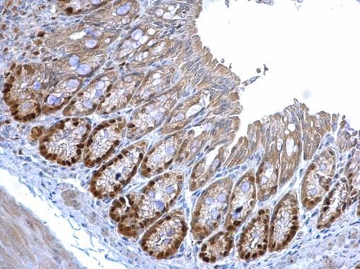 MCM3 Rabbit Polyclonal Antibody