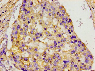 MCM3AP Antibody
