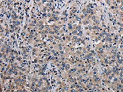 MCM3AP Antibody