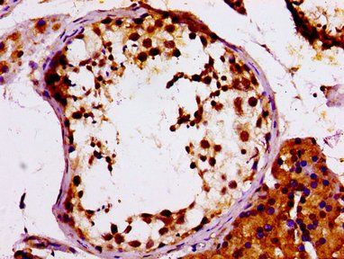 MCM4 Antibody