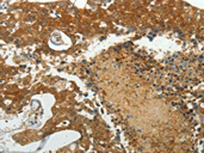 MCM4 Antibody