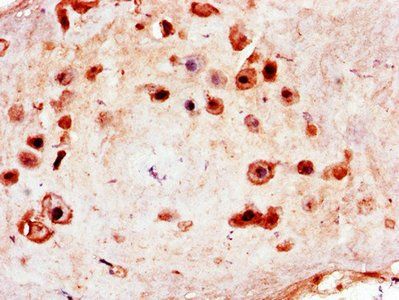 MCM8 Antibody