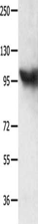 MCM8 Antibody