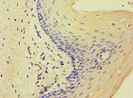 MCMBP Antibody
