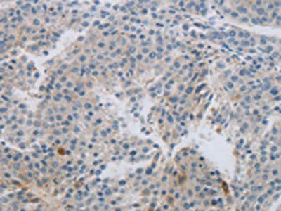 MCMBP Antibody