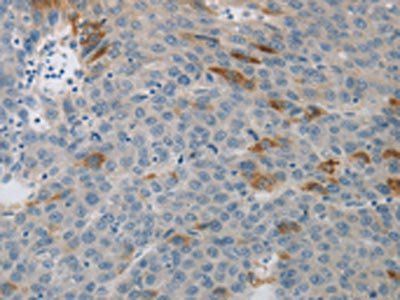 MCMBP Antibody