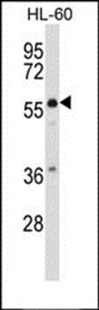 MCOLN3 antibody