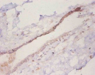 CCL2 Antibody