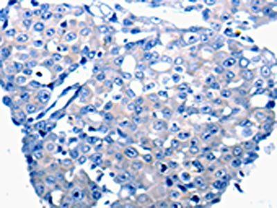 CCL2 Antibody