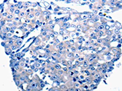 MCP1 antibody