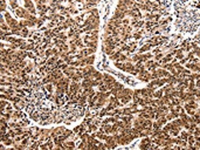 CCL2 Antibody