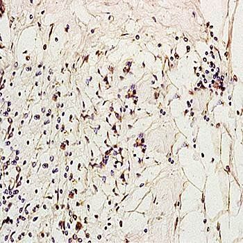 MCP-2 Rabbit Polyclonal Antibody