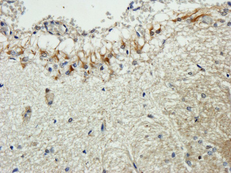 MCP3/CCL7 antibody