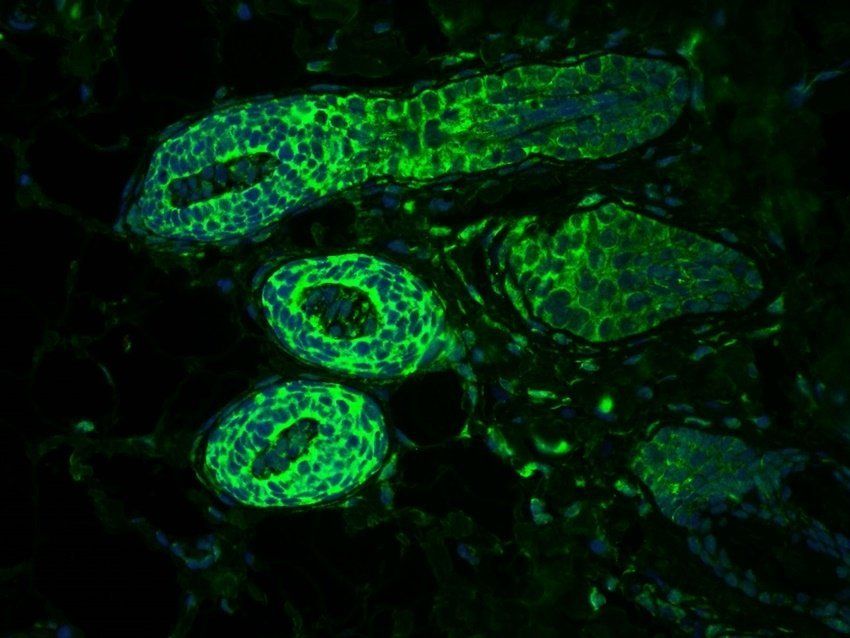 MCP3/CCL7 antibody (FITC)