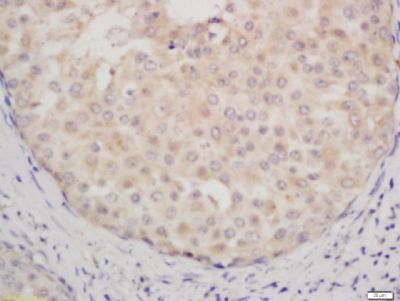 CCL12 Rabbit Polyclonal Antibody