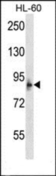 MCPH1 antibody