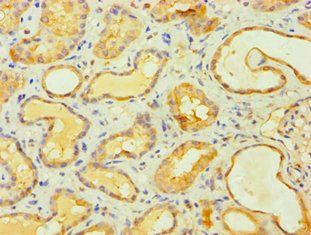 MCPH1 Antibody