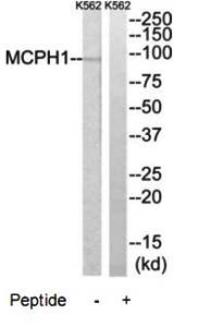 MCPH1 antibody