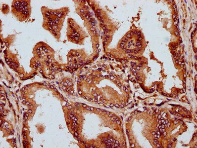 MCTP2 Antibody