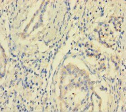 MCTS1 Antibody