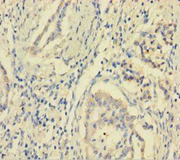 MCTS1 antibody